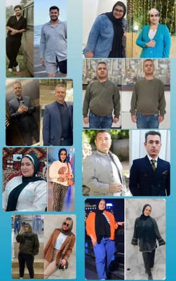 کپسول گاستریک بالن ٣٠ روزه