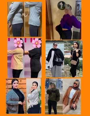 کپسول گاستریک بالن ۶٠ روزه